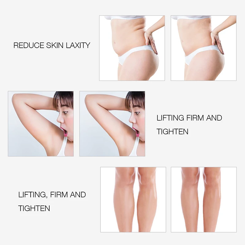 EMS & RF Radio Frequency Body Slimming Machine Fat Burner Slim Shaping Device LED Light Therapy Lose Weight Cellulite Massager