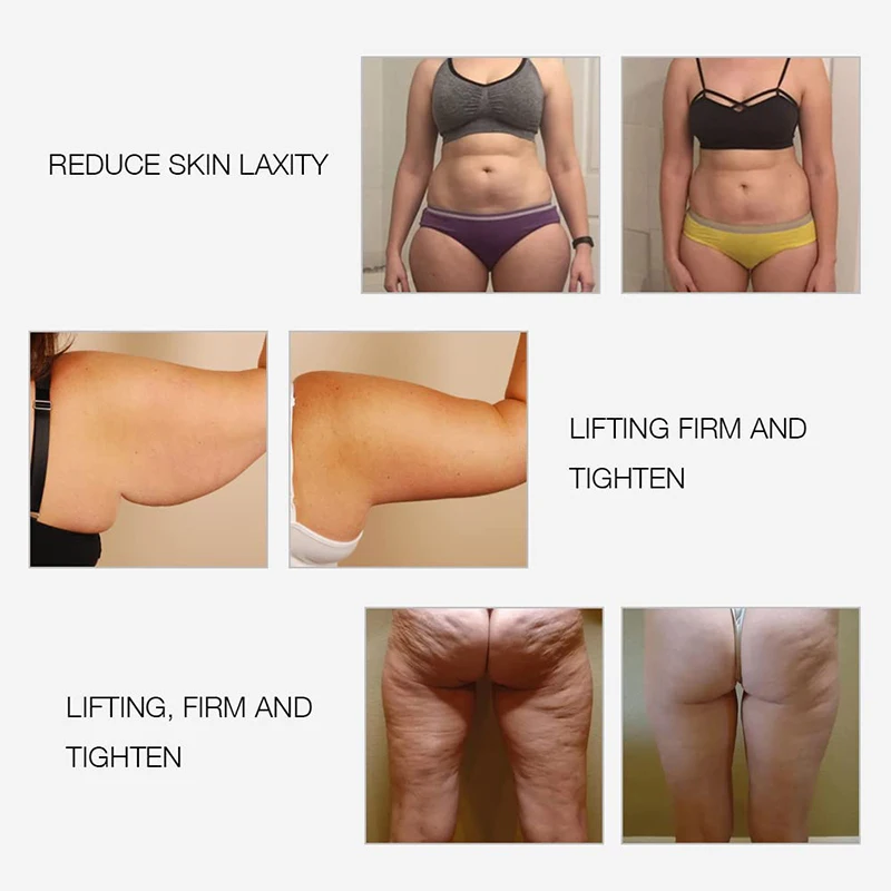 EMS & RF Radio Frequency Body Slimming Machine Fat Burner Slim Shaping Device LED Light Therapy Lose Weight Cellulite Massager