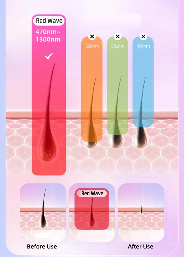 Body Bikini IPL 999,999 Flashes Depilator Pulses Permanent Laser Epilator Painless For Women Hair Removal Home Use Devices Body Bikini IPL 999,999 Flashes Depilator Pulses Permanent Laser Epilator Painless For Women Hair Removal Home Use Devices