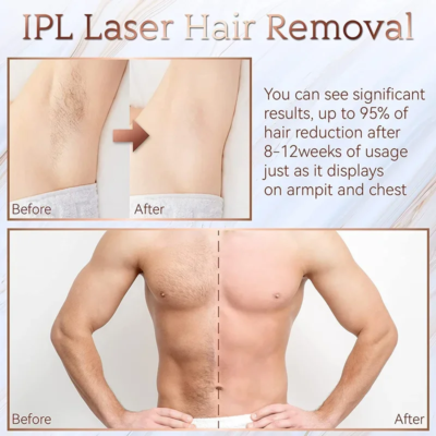 Body Bikini IPL 999,999 Flashes Depilator Pulses Permanent Laser Epilator Painless For Women Hair Removal Home Use Devices - Image 3