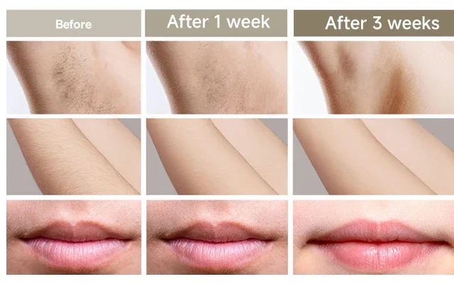 Body Bikini IPL 999,999 Flashes Depilator Pulses Permanent Laser Epilator Painless For Women Hair Removal Home Use Devices Body Bikini IPL 999,999 Flashes Depilator Pulses Permanent Laser Epilator Painless For Women Hair Removal Home Use Devices