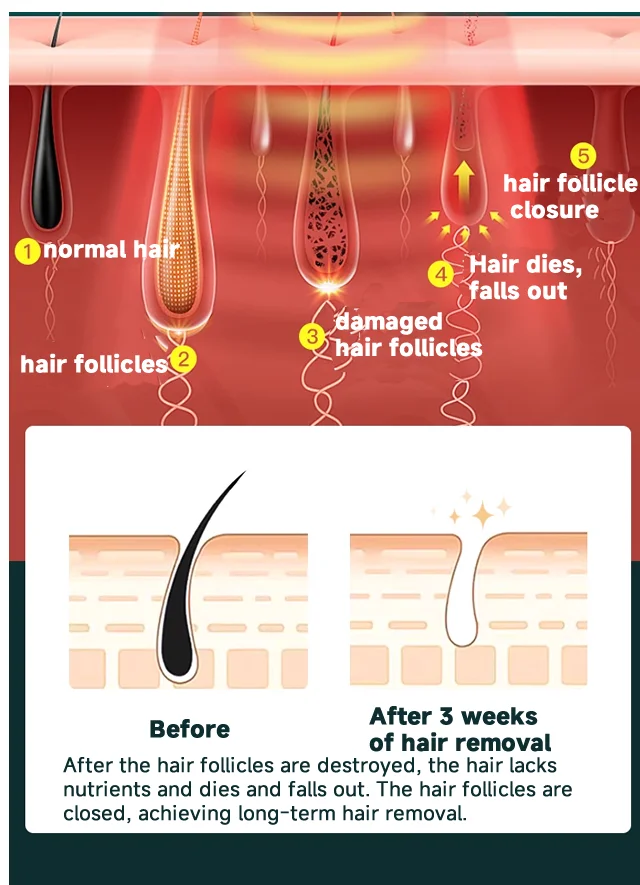 Body Bikini IPL 999,999 Flashes Depilator Pulses Permanent Laser Epilator Painless For Women Hair Removal Home Use Devices Body Bikini IPL 999,999 Flashes Depilator Pulses Permanent Laser Epilator Painless For Women Hair Removal Home Use Devices