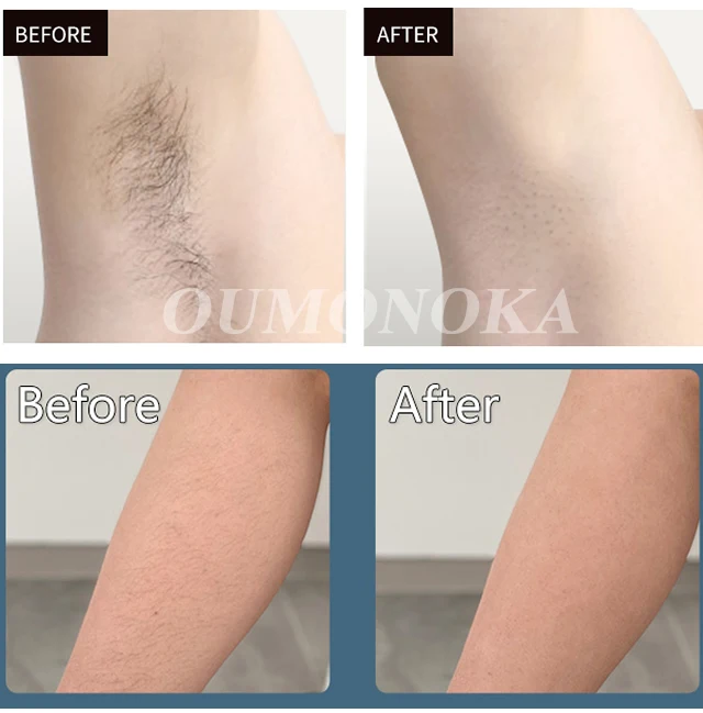 Body Bikini IPL 999,999 Flashes Depilator Pulses Permanent Laser Epilator Painless For Women Hair Removal Home Use Devices Body Bikini IPL 999,999 Flashes Depilator Pulses Permanent Laser Epilator Painless For Women Hair Removal Home Use Devices