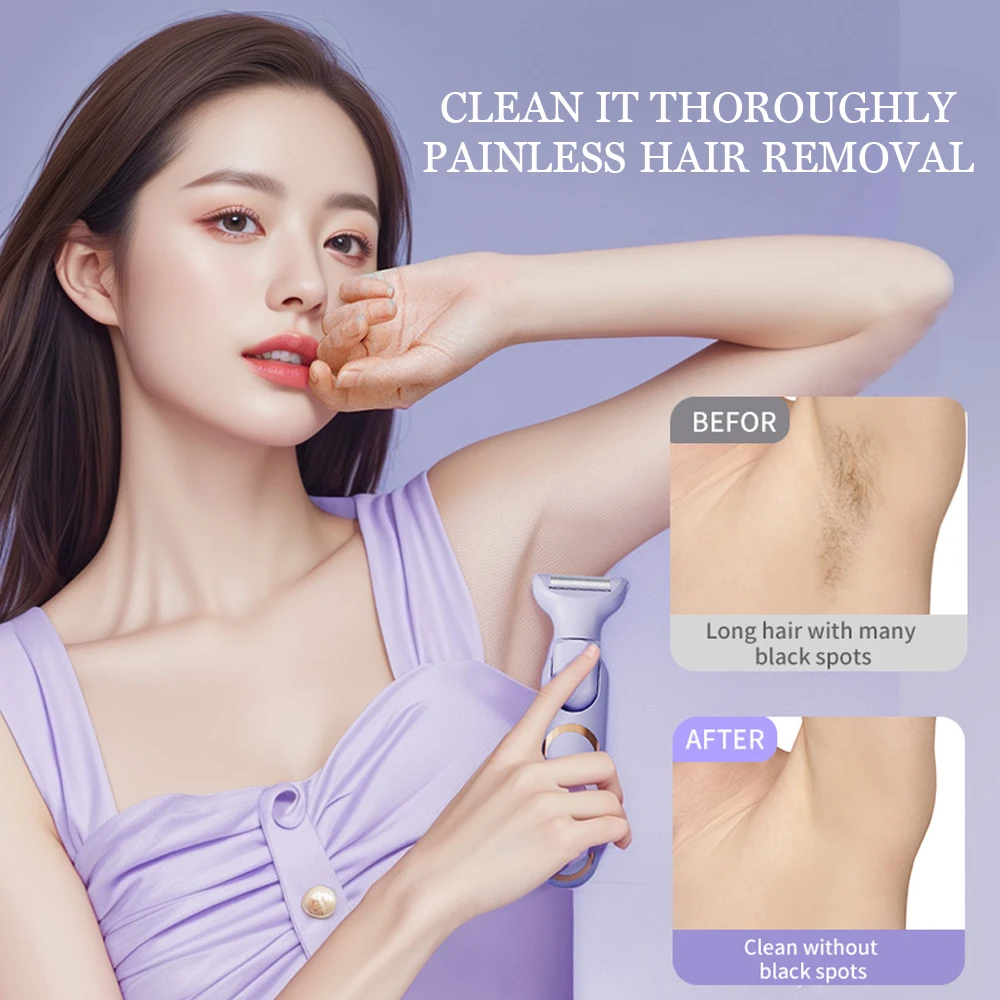 5 In 1 Electric Body Hair Trimmer Leg Body Hair Removal Lip Chin Depilatory Lady Bikini Trimmer Facial Hair Remover Shaver 5 In 1 Electric Body Hair Trimmer Leg Body Hair Removal Lip Chin Depilatory Lady Bikini Trimmer Facial Hair Remover Shaver