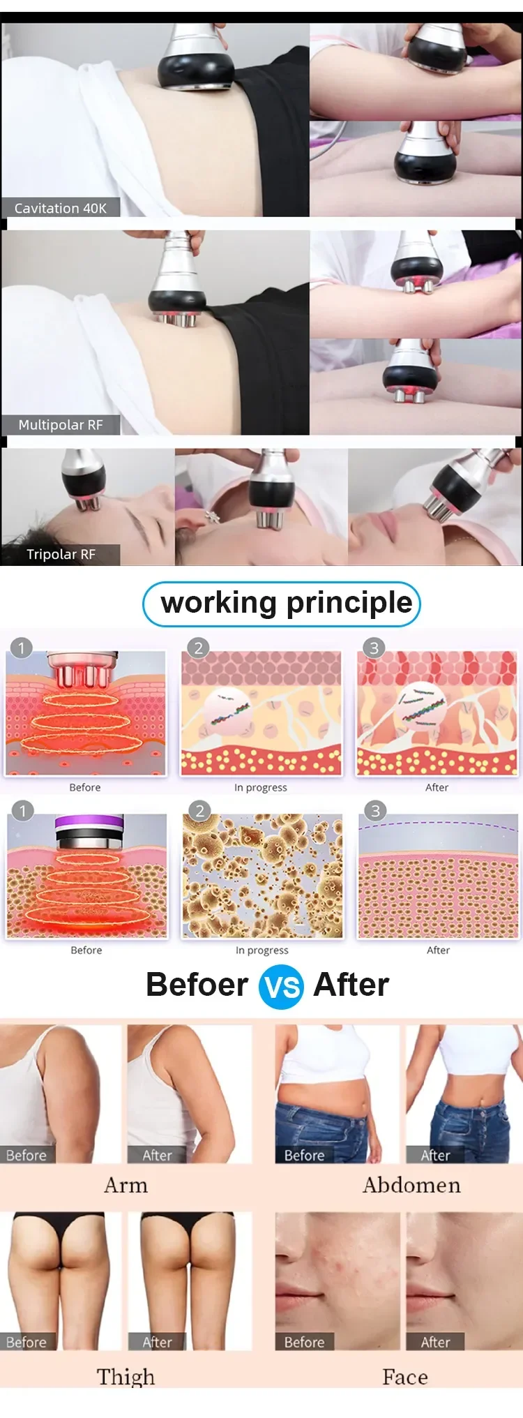 3 In 1 40K Cavitation Body Slimming Machine Facial Massager Skin Tighten Face Lifting Vacuum Suction wrinkle removal 3 In 1 40K Cavitation Body Slimming Machine Facial Massager Skin Tighten Face Lifting Vacuum Suction wrinkle removal