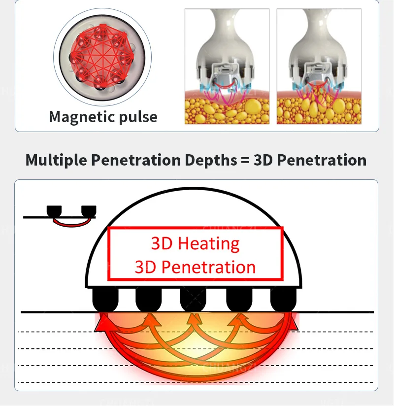 Professional multi-function wrinkle removal. Lose weight. Firms the skin. Integrated machine. We sell at factory price.