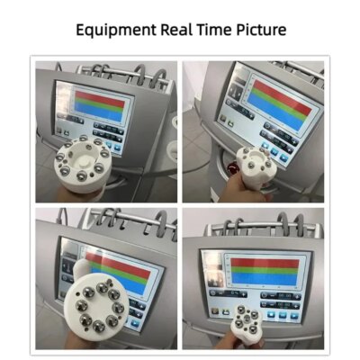 Professional multi-function wrinkle removal. Lose weight. Firms the skin. Integrated machine. We sell at factory price. - Image 5