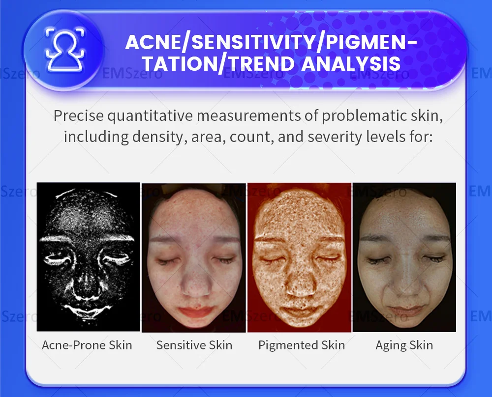 Facial Aesthetics Face Scanner 3D Face Scanner Skin Analysis Apparatus Face Scanner Skin Analyzer Skin Analysis Machine