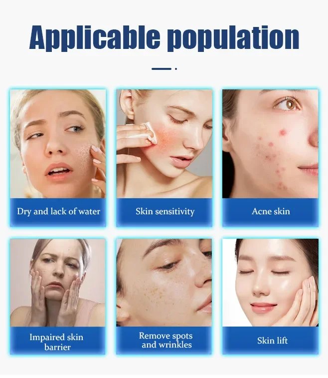 anti-aging Rejuvenation wrinkle Removal LDM Face Lifting Micromass  Firming Weight Loss Salon Anti-aging Collagen Beauty Machine