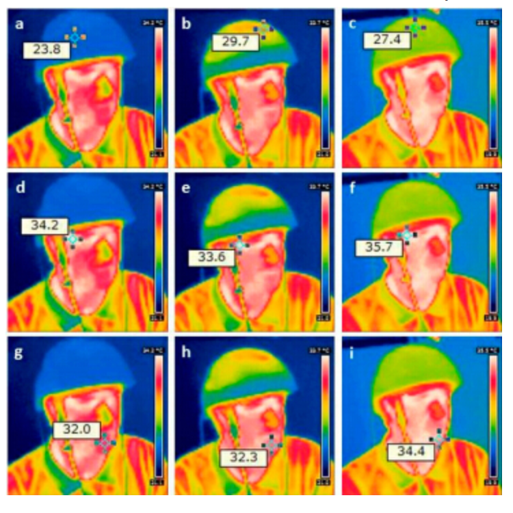 Transcranial Magnetic Brain Photobiomodulation Infrared 810nm Neurofeedback Therapy Machine Pdt Treatment Photodynamic