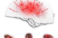 Transcranial Magnetic Brain Photobiomodulation Infrared 810nm Neurofeedback Therapy Machine Pdt Treatment Photodynamic