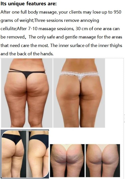 G9 Inner Ball Roller 360 Vibration Body Massager Weight Loss Machine 2/3/4/5/6/7 Handles Roller Therapy