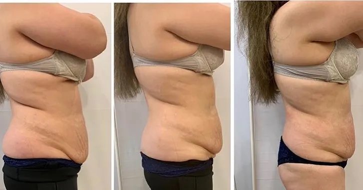 INDIBA 448K CET RET Diathermy Tecar Body Rehabilitation Terapia Pain Relief Physiotherapy INDIBA 448K CET RET Diathermy Tecar Body Rehabilitation Terapia Pain Relief Physiotherapy