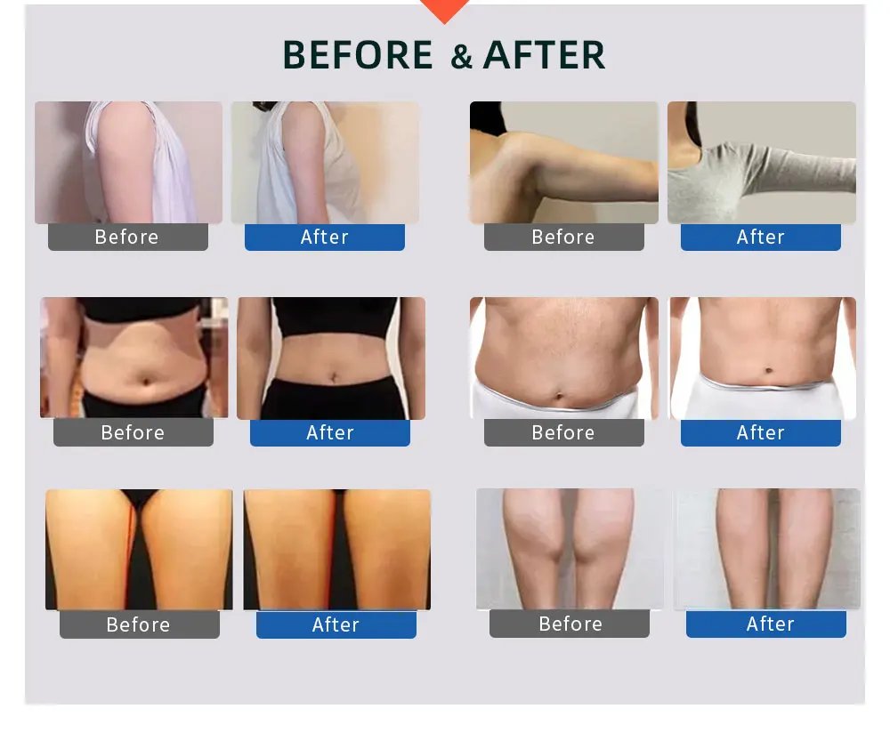 Wrvaro 3D Air Wave Pressure Lymphatic Drainage Vacuum Pressotherapy Machine Sauna Suit Weight Loss Body Shaping Massage Equipmen